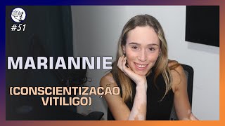 KNOW PODCAST #51 - MARIANNIE - (CONSCIENTIZAÇÃO VITILIGO)