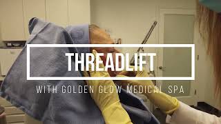 Patient Thread Lift