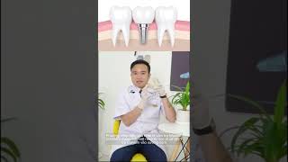 Tìm hiểu về sự khác nhau giữa bắc cầu sứ với căm trụ implant với Nha khoa sài gòn new.