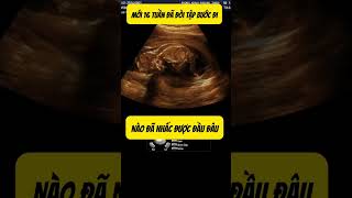 Hình ảnh bé 16 tuần tập bước đi #sieuamthai #mebau #pregnancy #ultrasound #baby #babau #beyeu#shorts