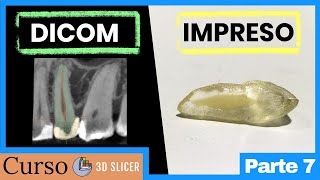 De DICOM a STL - Segmentación de tomografías con 3D Slicer - Curso COMPLETO parte 7