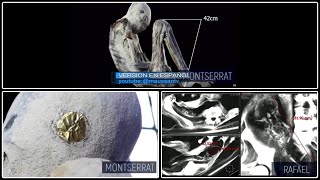 Tridactyl Beings of Nasca, Montserrat and baby Rafael