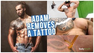 Laser Tattoo Removal in Miami | Adam Awada | Body Details