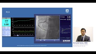 Case review: iFR Co-registration in 3 vessel disease with Dr. Arnold Seto