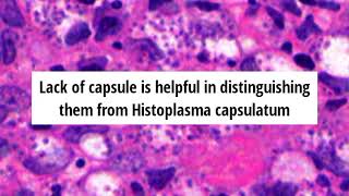 Pathology of Leishmaniasis by Dr Sampurna Roy MD