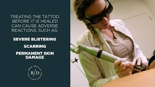 The 8 Week Healing Process of Laser Tattoo Removal