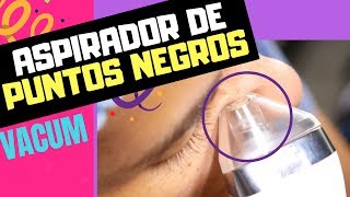 Usa este ASPIRADOR y REMUEVE Los Puntos NEGROS En 5 MINUTOS ( De Raiz😱)