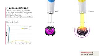 Discovery Pico Photoacustic Quanta System