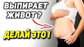 Выпирает живот, гиперлордоз, болит поясница, слабые ягодицы? ДЕЛАЙ ЭТО!