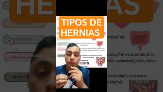 TIPOS DE HERNIAS 😱🧑‍⚕️ #hernias #sorprendente #medicina #medshorts #medstudent #foryou #interesting