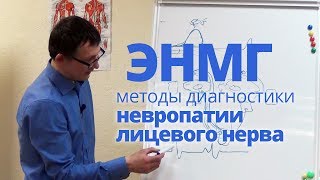 Невропатия лицевого нерва. ЭНМГ диагностика