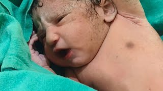 Cesarean baby healthy baby | My first long video cute baby in hospital