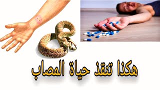 اسعافات أولية للتسمم والحروق ولدغة الثعبان | اشهر الأخطاء | first aid