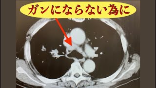 ガンにならない為に（動画本）