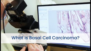 What is Basal Cell Carcinoma?