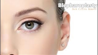 ❉ Powerful Blepharoplasty! ~ Dark Circles & Eye Bags Removal + Radiant Youthful Skin ~ Ocean Sounds