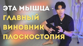 Вылечи эту МЫШЦУ и забудь про ПЛОСКОСТОПИЕ. Одно самое эффективное упражнение.