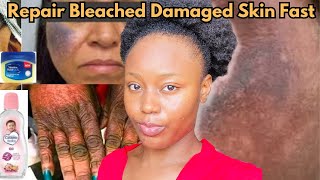 Repair Damaged Bleached Skin Fast ‼️ #skinbleach