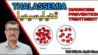 Thalassemia diagnosis ,prevention and treatment@talk with dr.Qadir khan