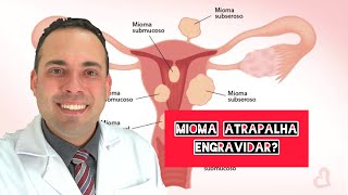 Mioma atrapalha engravidar? Existe remédio para mioma?