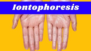 Iontophoresis | How to treat sweating on hand, feet, and underarm Area |  Physiotherapy