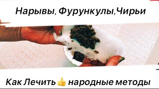 ЗНАХАРСКИЙ РЕЦЕПТ для Лечения ФУРУНКУЛОВ (ЧИРИЯ) за Одну Ночь👍Личный Опыт!!!Поможет Всем 100%!!!!