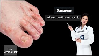 Gangrene lacture in Hindi (Medical surgical nursing) #svmedicourse #disease