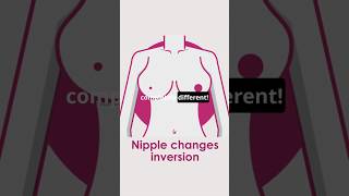 Nipple Slip  Medical Term or Sexual Erosion Shorts #infovorefreak #baby #medical