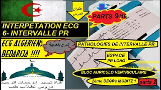 ECG ALGERIENS BEDARIJA 12.9 BLOC AURICULO VENTRICULAIRE 2 eme degrè mobits 1 part 2/2