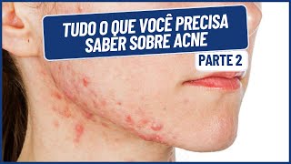 TUDO O QUE VOCÊ PRECISA SABER SOBRE ACNE - PARTE 2 | DR. JOÃO TASSINARY