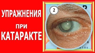 Упражнения для глаз. Для восстановления зрения. При катаракте