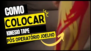 COMO COLOCAR KINESIO NO JOELHO PÓS OPERATÓRIO, LCP,LCA E MENISCO.