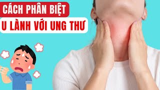 Phân Biệt U Lành Tuyến Giáp Và Ung Thư Tuyến Giáp | Bác sĩ Chiều