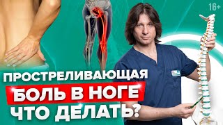 Почему боль в пояснице отдает в ногу? Как лечить защемление седалищного нерва? //16+