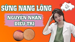 Xử trí VIÊM NANG LÔNG - DÀY SỪNG NANG LÔNG tận gốc | Ngọc Nguyễn