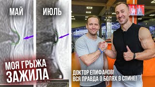 Правильные тренировки при болях в спине и вся правда о грыжах! Доктор Антон Епифанов