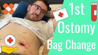 🏠Home Health Ostomy Bag💩 - Changing and Learning📚