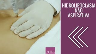 Hidrolipoclasia não Aspirativa Lipo Não Invasiva | Fisest