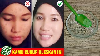 Tips Cara Menghilangkan Flek Hitam di Wajah Usia 40 Tahun Dengan Cepat