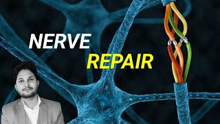 Nerve repairing enzyme