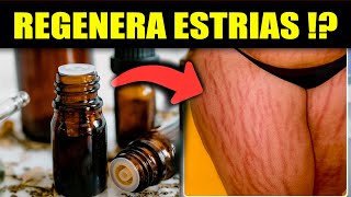 10 ÓLEOS ESSENCIAIS [Provados pela CIÊNCIA] REGENERAM ESTRIAS VERMELHAS E BRANCAS- COMO USAR!