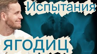 Ищем причину боли в ягодицах | 10 тестов для врача | Доктор Епифанов