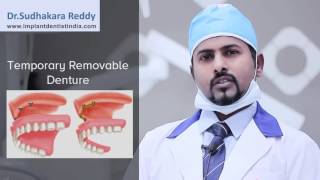 Single Tooth implants In Bangalore |  Dental Implants Hospital In India