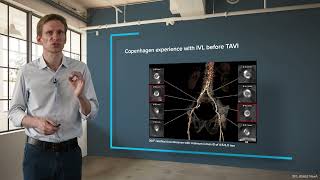 The Copenhagen Experience: IVL Pre TAVI Tutorial Chapter 3 with Dr. Ole de Backer