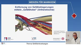 Gefäßerkrankungen: Wie funktioniert das interdisziplinäre Gefäßzentrum?