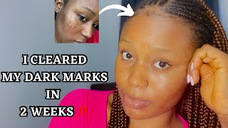 PRODUCTS THAT CLEARED MY DARK SPOTS IN 2 WEEKS 🤯