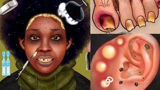 ASMR Care Animation  😳| Acne Removal | Pimple Removal & Makeup APPLICATION