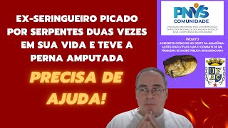 EX-SERINGUEIRO PICADO POR SERPENTE DUAS VEZES EM SUA VIDA E TEVE A PERNA AMPUTADA PRECISA DE AJUDA!