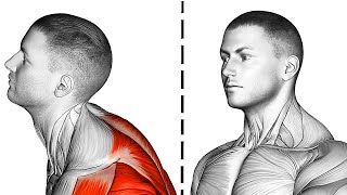 6 Exercises to Improve Forward Head Posture