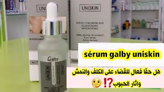 حقيقة سيروم galby لازالة التصبغات والكلف والنمش واثار الحبوب وتفتيح ونضارة البشرة